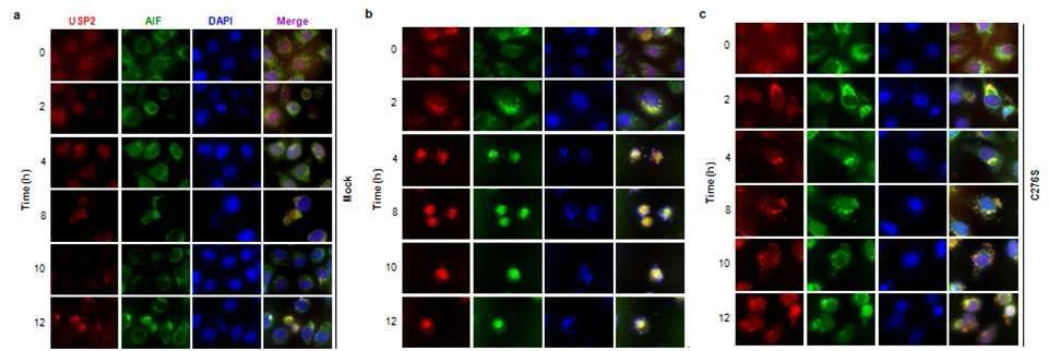 AIF를 통한 caspase-비의존적 세포사멸에 있어서의 USP2 활성의 영향