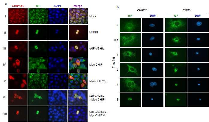 AIF를 통한 카스파아제 비의존적 세포사멸에 있어서의 CHIP 활성의 영향