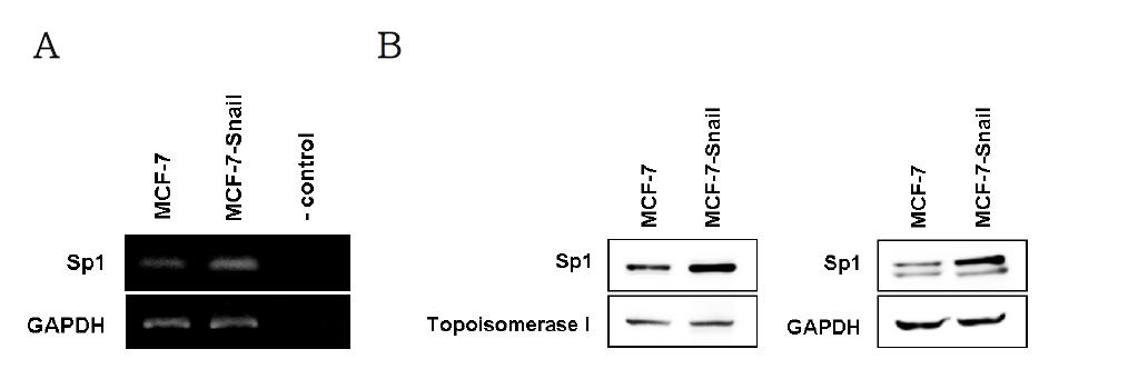 MCF7과 MCF7-Snail cell에서의 Sp1의 발현 분석