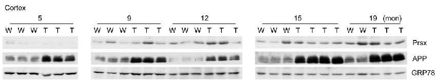 연령에 따른 APP/PS1 double transgenic mice에서의 Prsx의 발현 분석