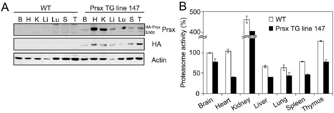 Prsx tg mice에서 Prsx의 발현 확인과 proteasome 활성 측정