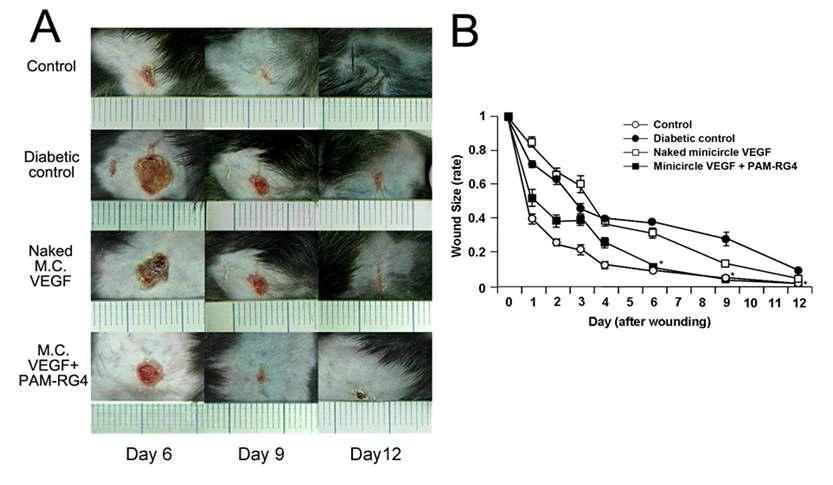 PAM-RG4를 전달체로 하여 minicircle VEGF165를 전달했을 때 상처 치유 효과가 향상되었다.