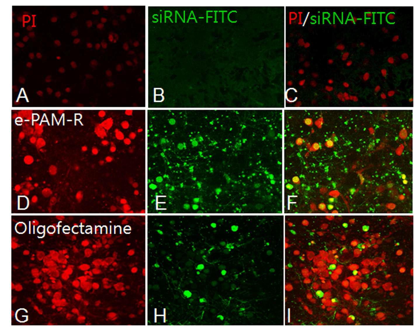 1차 대뇌피질 배양 신경세포에서 siRNA/e-PAM-R 또는 siRNA/oligofectamine복합체를 transfection 후 24 시간 후에 tranfection indicator siRNA의 전달 효율을 confocal microscopy를 통해 비교 조사함.