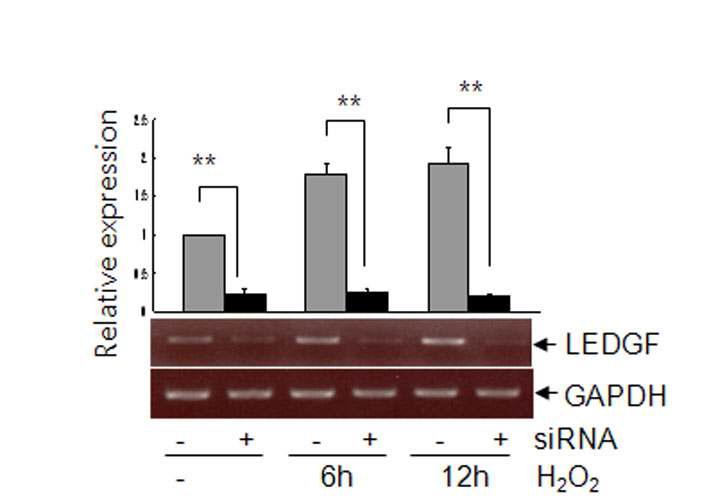 C6 astroglioma 세포주에서의 e-PAM-R의 siRNA 전달 효율을 LEDGF siRNA를 사용하여 조사