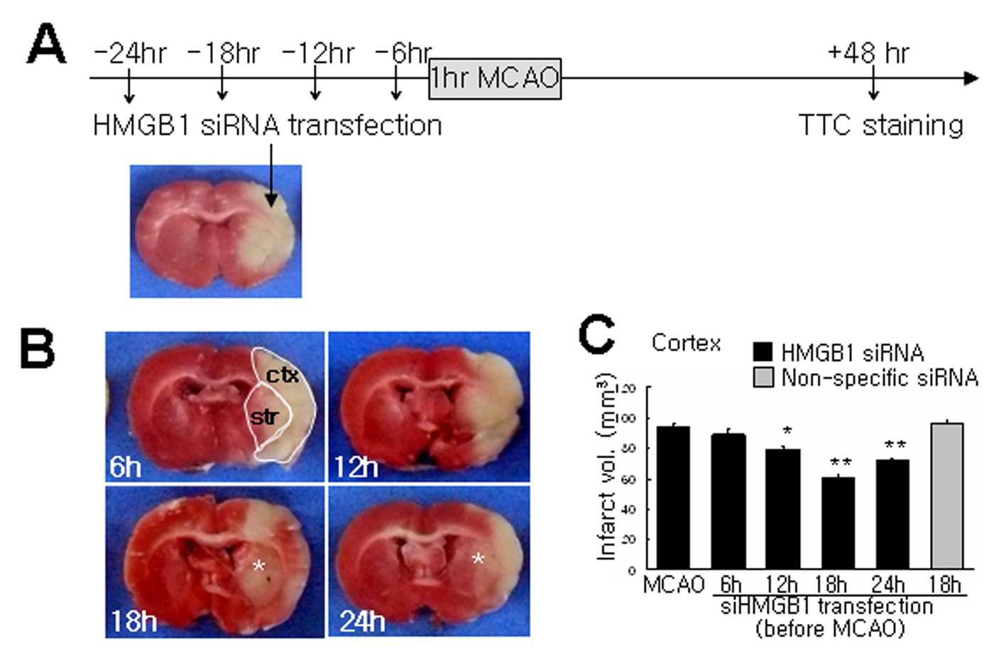 60분 뇌졸중 동물 모델 (MCAO) 제작 24, 18, 12, 6시간 전에 siRNA (500 ng)을 ePAM-R를 사용하여 투여 한 후 48시간 후에 TTC 염색을 사용하여 뇌경색 부피 측정
