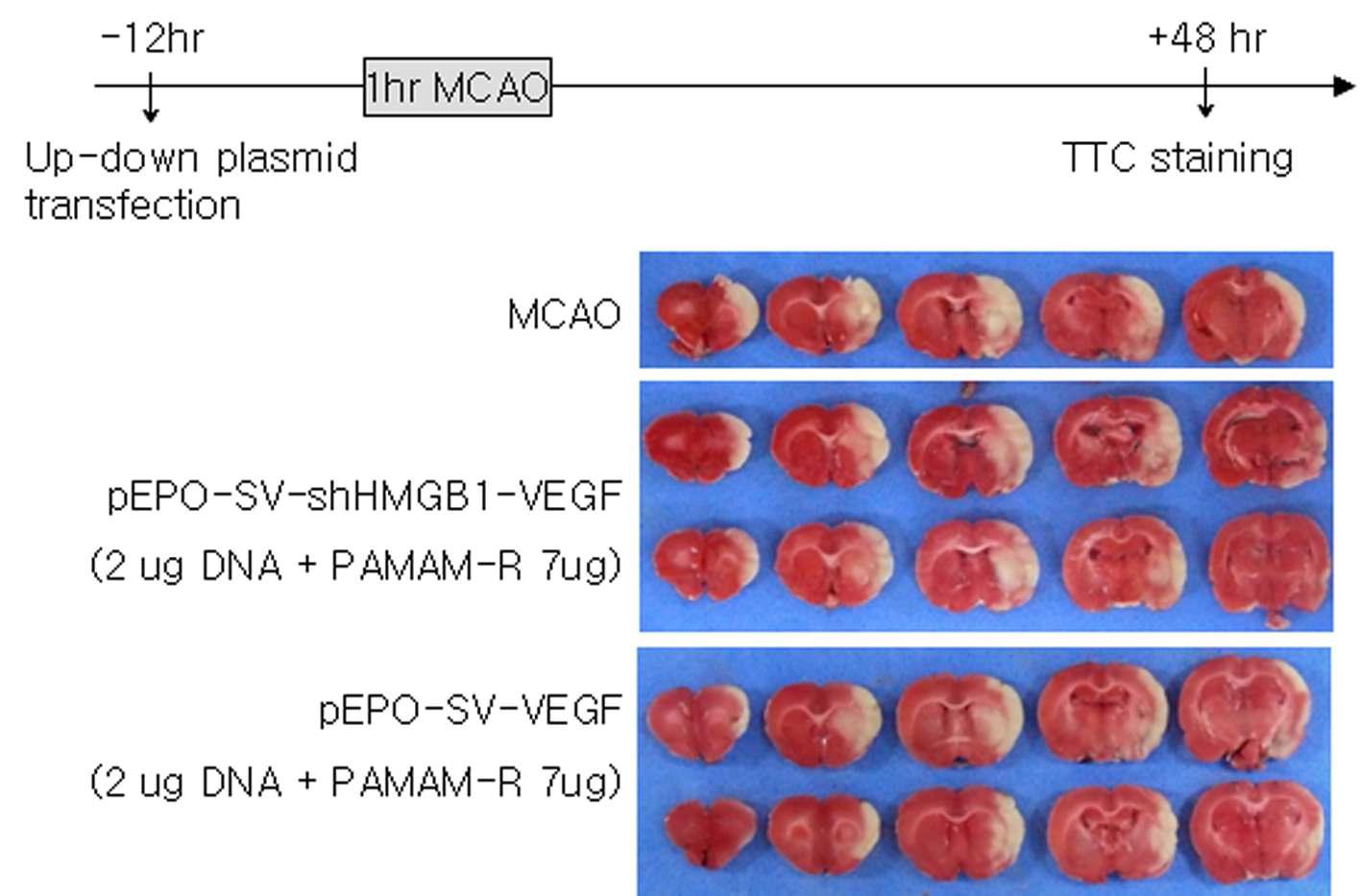두 종류의 plasmid를 대뇌 피질에 injection 한 후 12시간 후에 MCAO를 시행하여 뇌경색의 크기를 조사함.