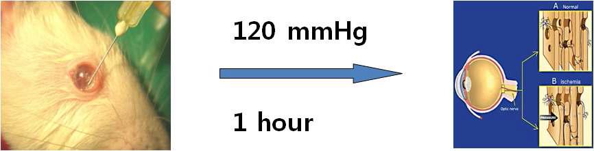 Animal model of pressure-induced glaucoma-like ischemic retina of rat.