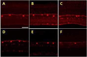 Confocal microphotographs of the retinal sections of normal (A), 7 days (B) and 28 days(C) after EVC, and 1 day(D), 3 days (F) and 14 days(F) after IR, which were processed for anti-calbindin immunohistochemistry.