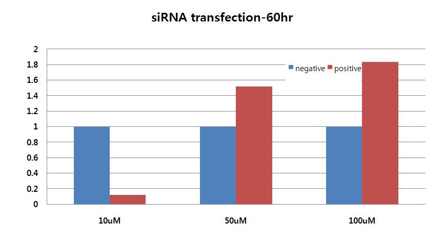 RT-PCR analysis of transfection levels of calbindin siRNA in retinal explants according to its applying concentrations.