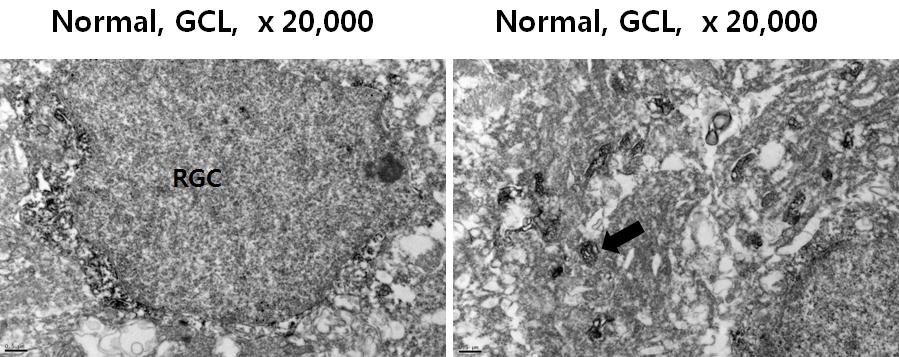 Electron microphotographs taken from a part of OPN immunostained retinal sections of normal rat retina. OPN immunoreactivity appeared in the ganglion cell layer.