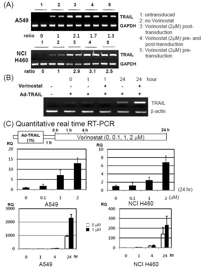 (A) RT-PCR for TRAIL. (B) Sequential RT-PCR. (C) Quantitative real-time PCR.