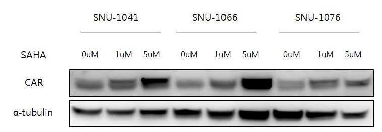 Coxsackie adenoviral receptor (CAR) increased when cells were treated with SAHA at a dose of 1 μM and 5 μM for 48 h in the head and neck cancer cell lines SNU-1041, SNU-1066 and SNU-1076.