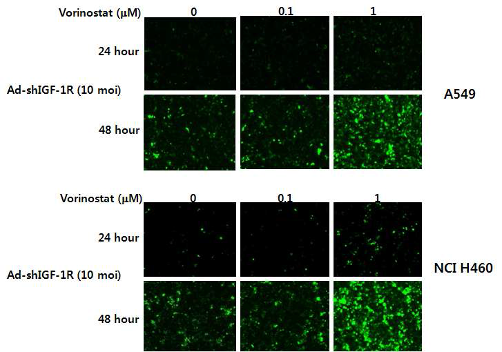 Enhanced expression of GFP from cells transduced with ad-shIGF1R-GFP by vorinostat.