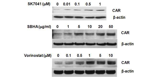 HDAC inhibitors increased CAR expression in lung cancer cells.