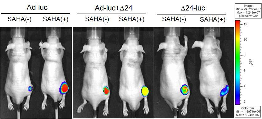 Effect of vorinostat on in vivo luciferase expression from ad-luc, ad-luc + ∆24 and ∆24-luc injected tumor mass (in vivo tumor imaging)