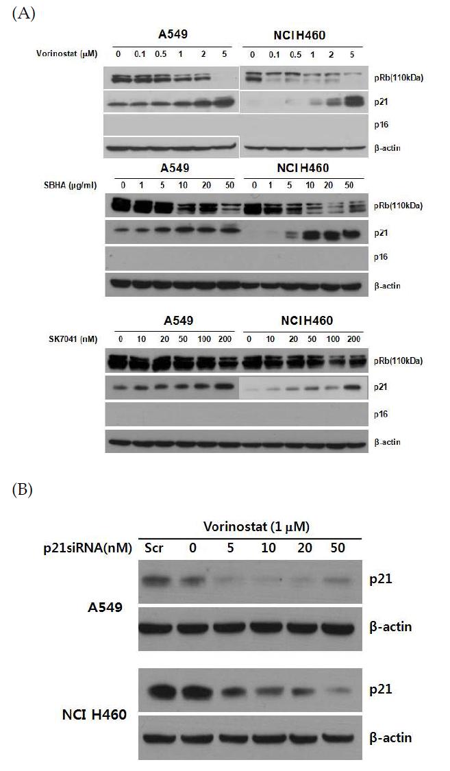 (A) Increased expression of p21 by HDCA inhibitors in lung cancer cell lines. (B) Suppression of p21 induction due to HDAC inhibitor (Vorinostat) by p21 siRNA