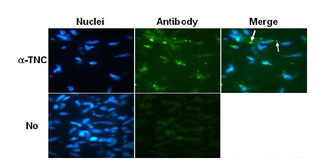 Specific detection of U118MG xenograft model with the anti-TNC antibody