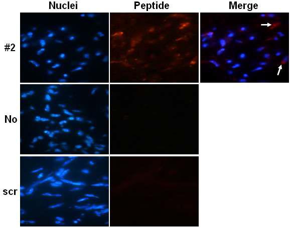 Specific detection of U118M G xenograft model with the biotin-peptide #2