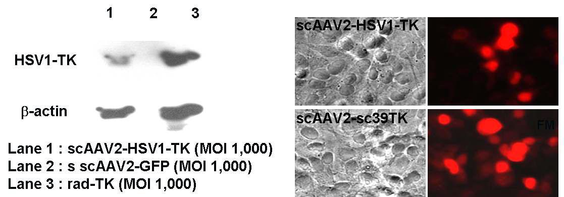 W estern-blot (L) and immunocytochemistry (R) specific to TK