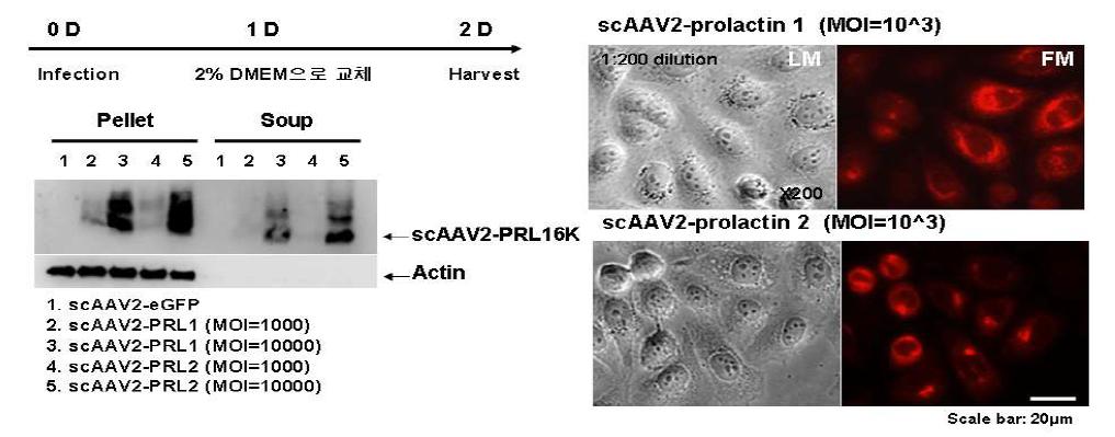 PRL 발현 확인: western-blotting (좌), immunocytochemistry (우)