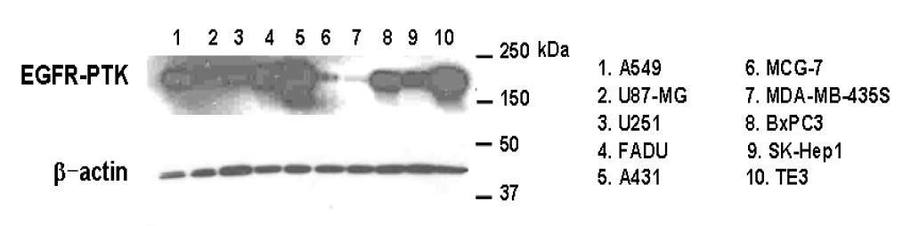 각종 암세포주의 EGFR 발현정도 분석: Western-blotting