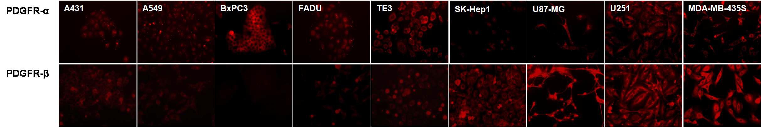 각종 암세포주의 PDGFR-α, β 발현 정도 분석 : immunocytochemistry