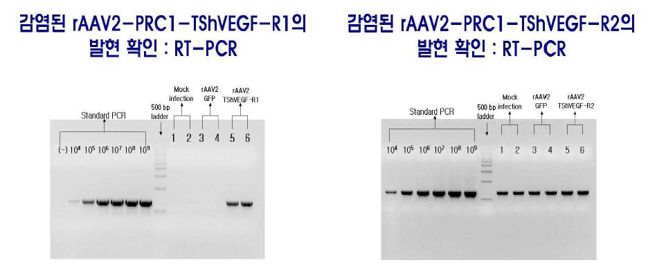 RT-PCRs of the expressed truncated soluble human VEGF receptor-1 (R1) and receptor 2 (R2) in HUVEC infected with rAAV2-PRC1-TShVEGF-R1/R2