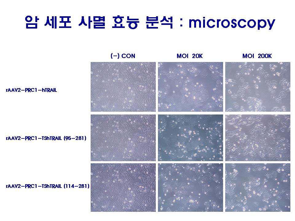 Relative cell deaths in HeLa cells infected with rAAV2-PRC1-hTRA IL, TShTRA IL(95-281) or TShTRA IL(114-281) monitored by a microscopy