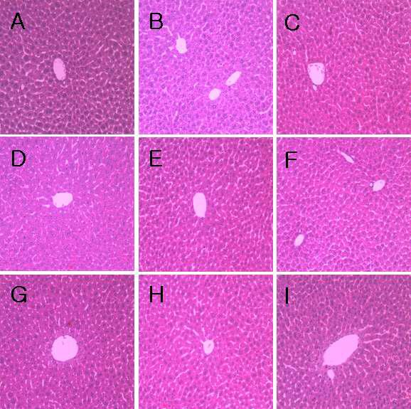 H&E Staining - Liver