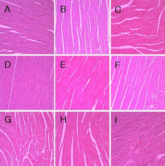 H&E Staining - Heart