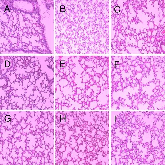 H&E Staining - Lung