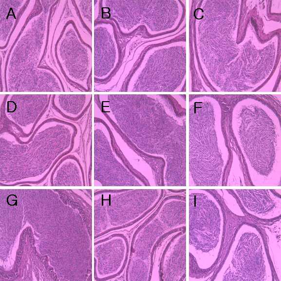 H&E Staining - Epididymis