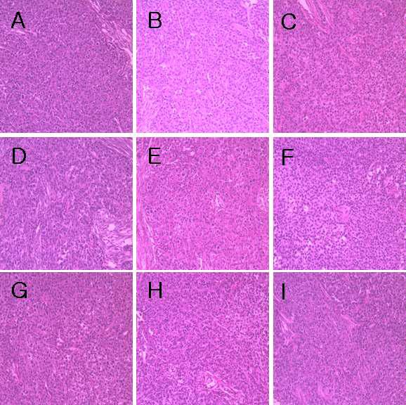 H&E Staining - Tumor