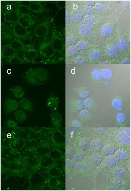 Hela cell에서의 Confocal microscopy image. 2 (a, b), 4 (c, d), 6 (e, f) ; 농도 : 500nM. 핵 염색은 Hoechst 33258 dye 사용..