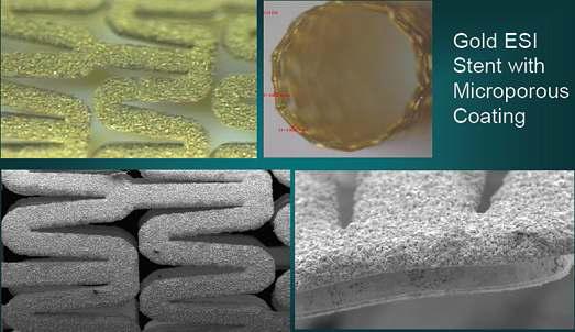 Electroforming process법으로 제작된 microporous gold stent