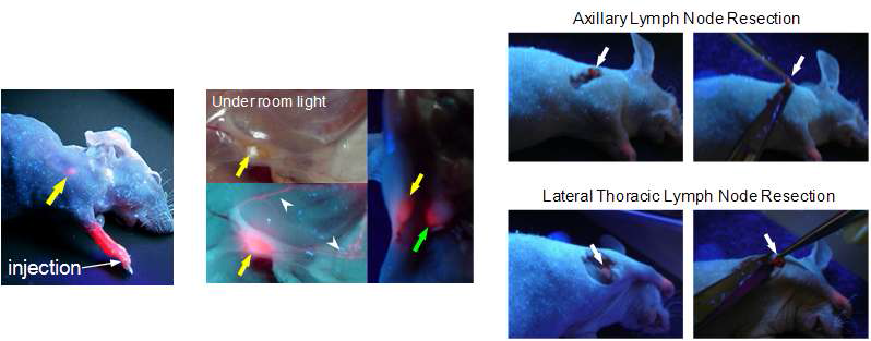 체외적(좌) 및 수술중(중, 우) 365 nm UV 램프 하에서 육안으로 관측된 감시림프절의 형광 사진