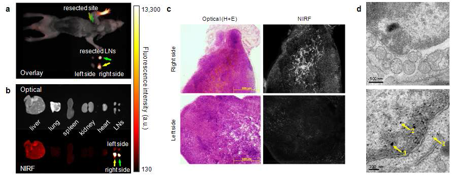 ex vivo 영상(좌), 감시림프절 조직(중, H-E staining) 및 세포(우, TEM) 사진