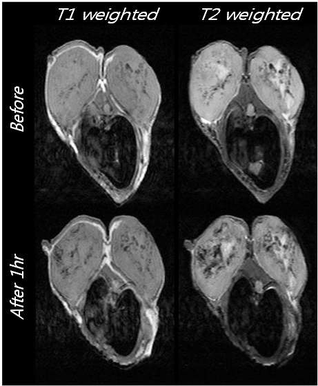 Gd-PEI 나노겔을 정맥주사하기 전과 주사한 1시간 후의 T1, T2 MR 이미지