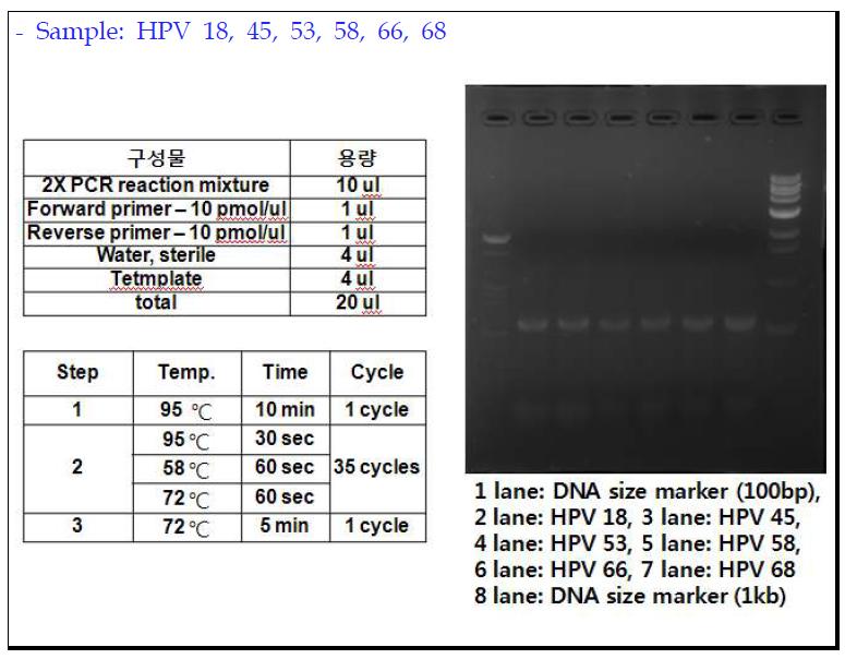 HPV Genotype sample의 gel 분석 결과