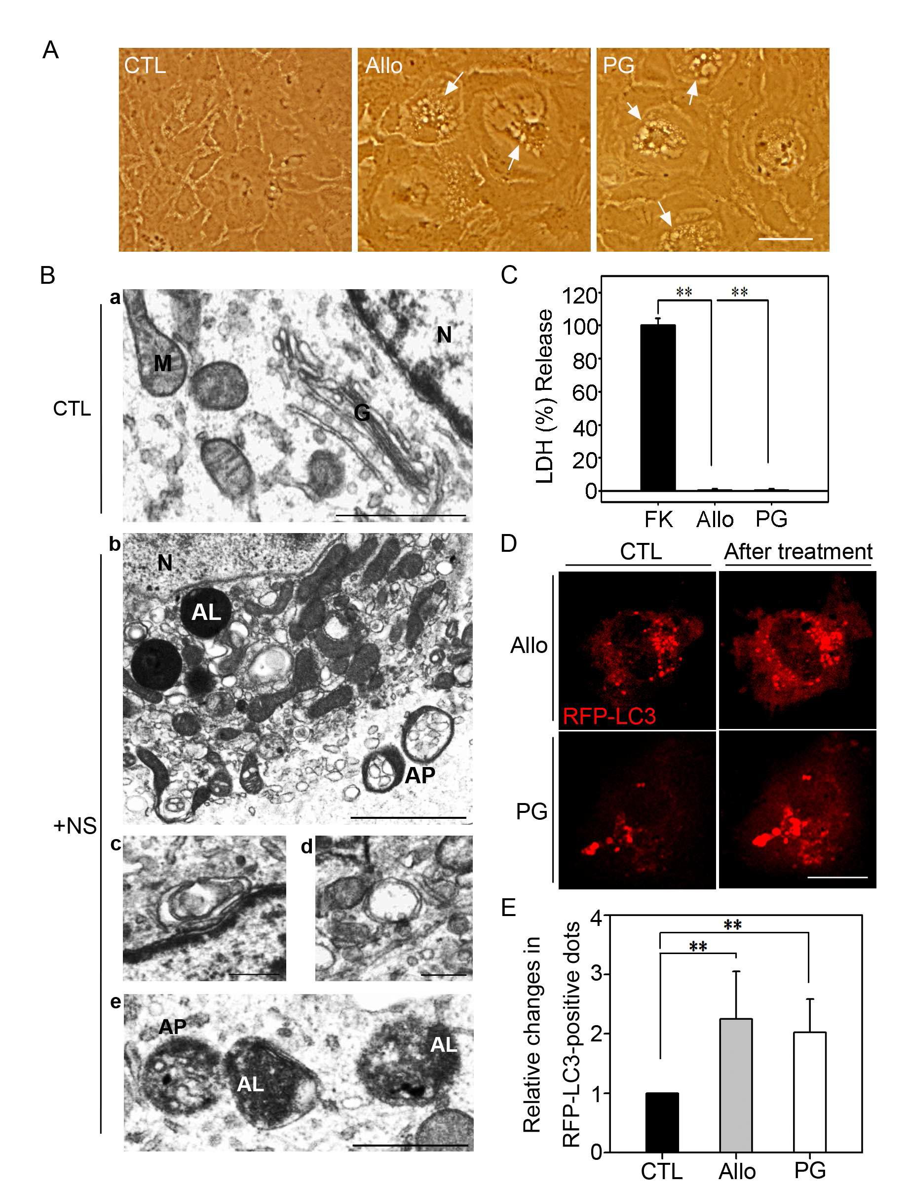 neurosteroid에 의한 AV의 증가