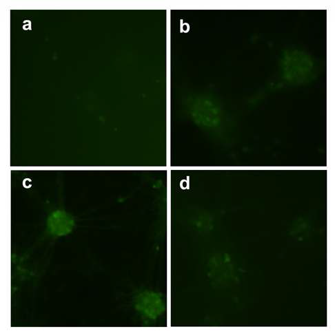 angiotensin II에 의해 세포내 활성산소 증가