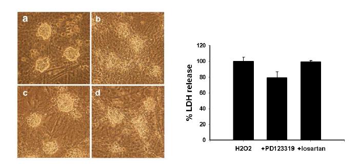 H2O2 에 의한 신경세포고사과정에서 PD123,319 , losartan의 효과