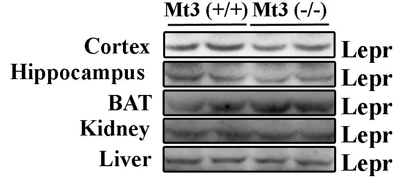 MT3 WT 과 KO의 MT3이 발현되지 않는 기관에서 leptin receptor 발현 비교