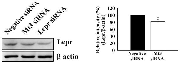 MT3 siRNA 시행 후 MT3과 leptin receptor의 연관성