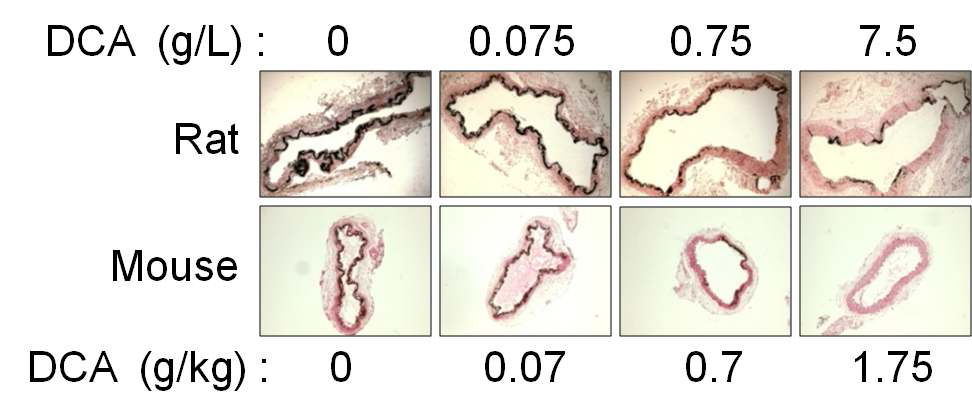 DCA에 의한 혈관석회화 억제능력을 동물모델(위: rat, 아래: 마우스)에서 검증
