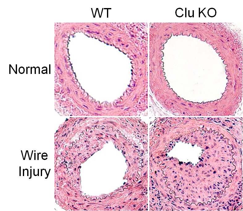 강선 유도모델에서 정상 마우스에 비해 Clu KO에서 혈관평활근세포의 증식과 이주가 훨씬 증가되었음.