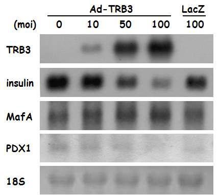 TRB3 과발현에 따른 인슐린유전자 및 인슐린 유전자 발현 조절인자의 발현을 Nothern blotting으로 확인