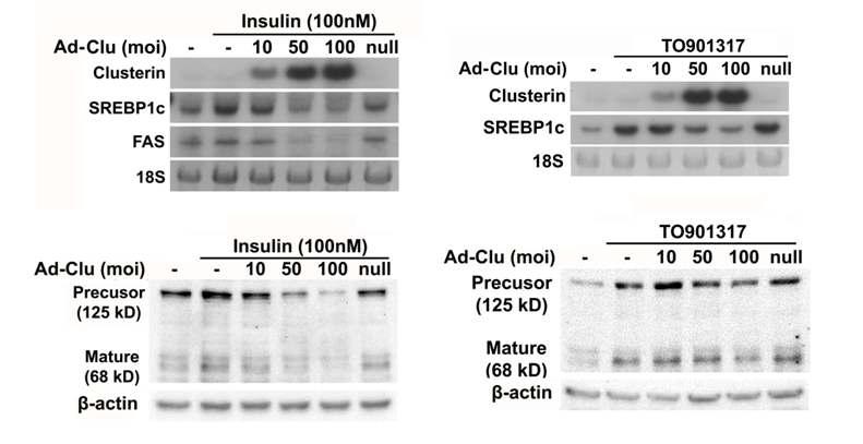 Clusterin은 인슐린과 LXR의 리간드 (TO901317)에 의해 증가된 SREBP1c의 발현을 감소시킴