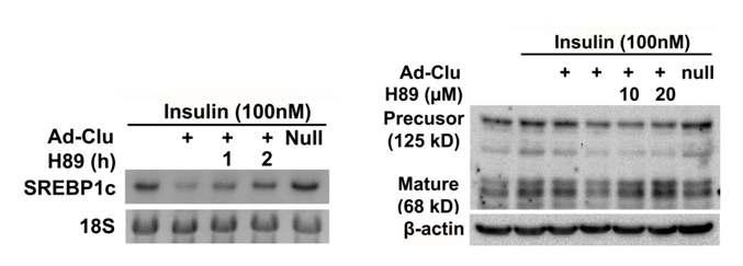 Clusterin은 PKA 신호전달을 통해 SREBP1c의 발현을 억제함.