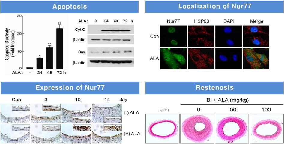 ALA가 Nur77의 제어를 통해 혈관평활근세포의 apoptosis와 혈관재협착의 제어시스템 확인함.